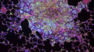 Lung Infiltrate - Francisella Tularensis, Joseph Horzempa Research